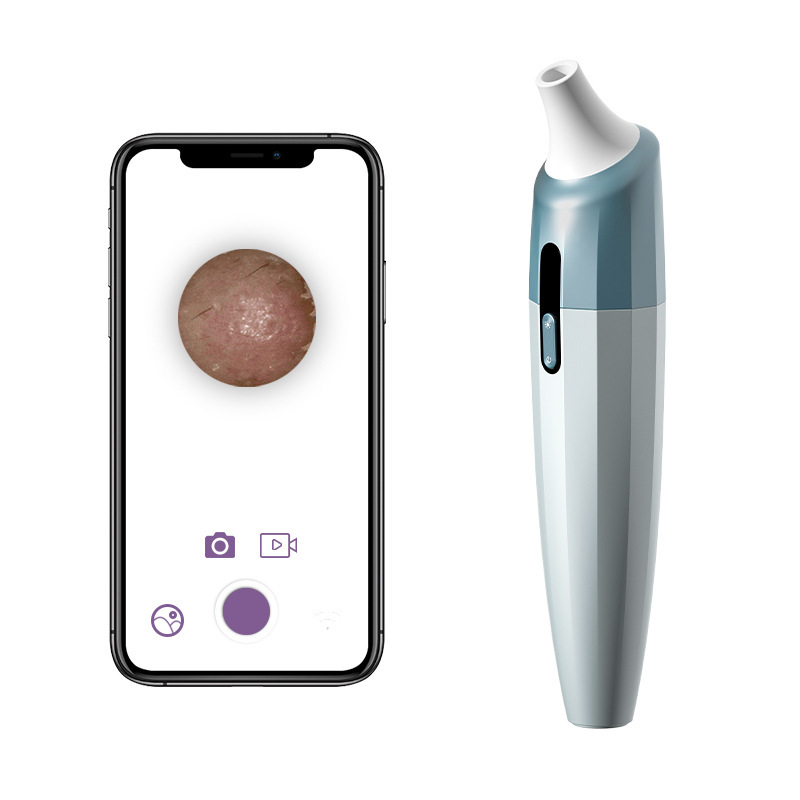 Electric Beauty Visualization Blackhead Instrument - Image 5