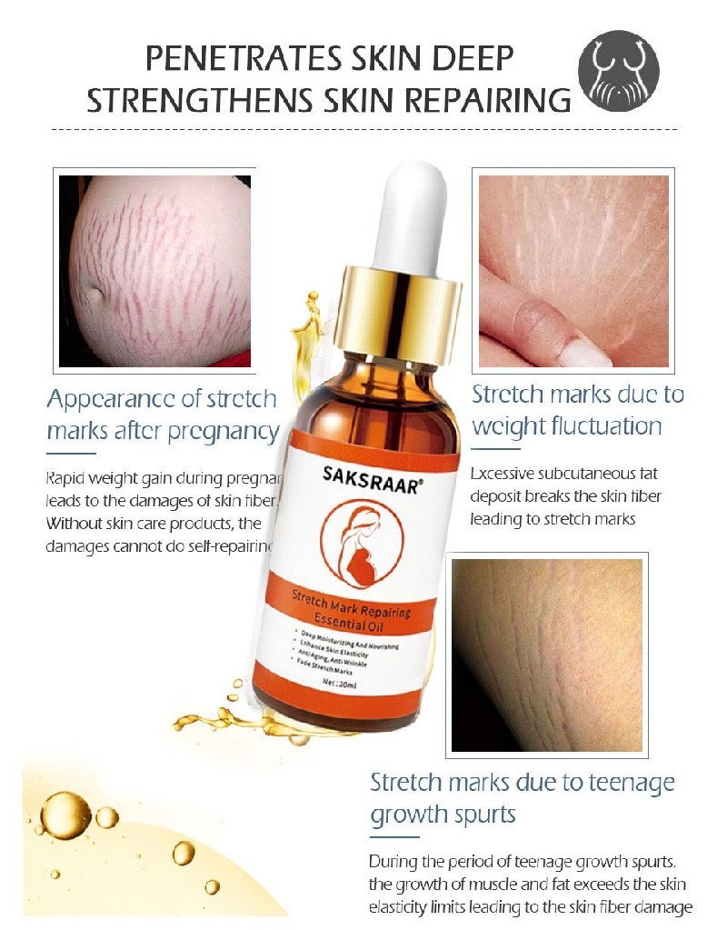 Stretch Mark Remover Essential Oil Care Cream – Bild 8